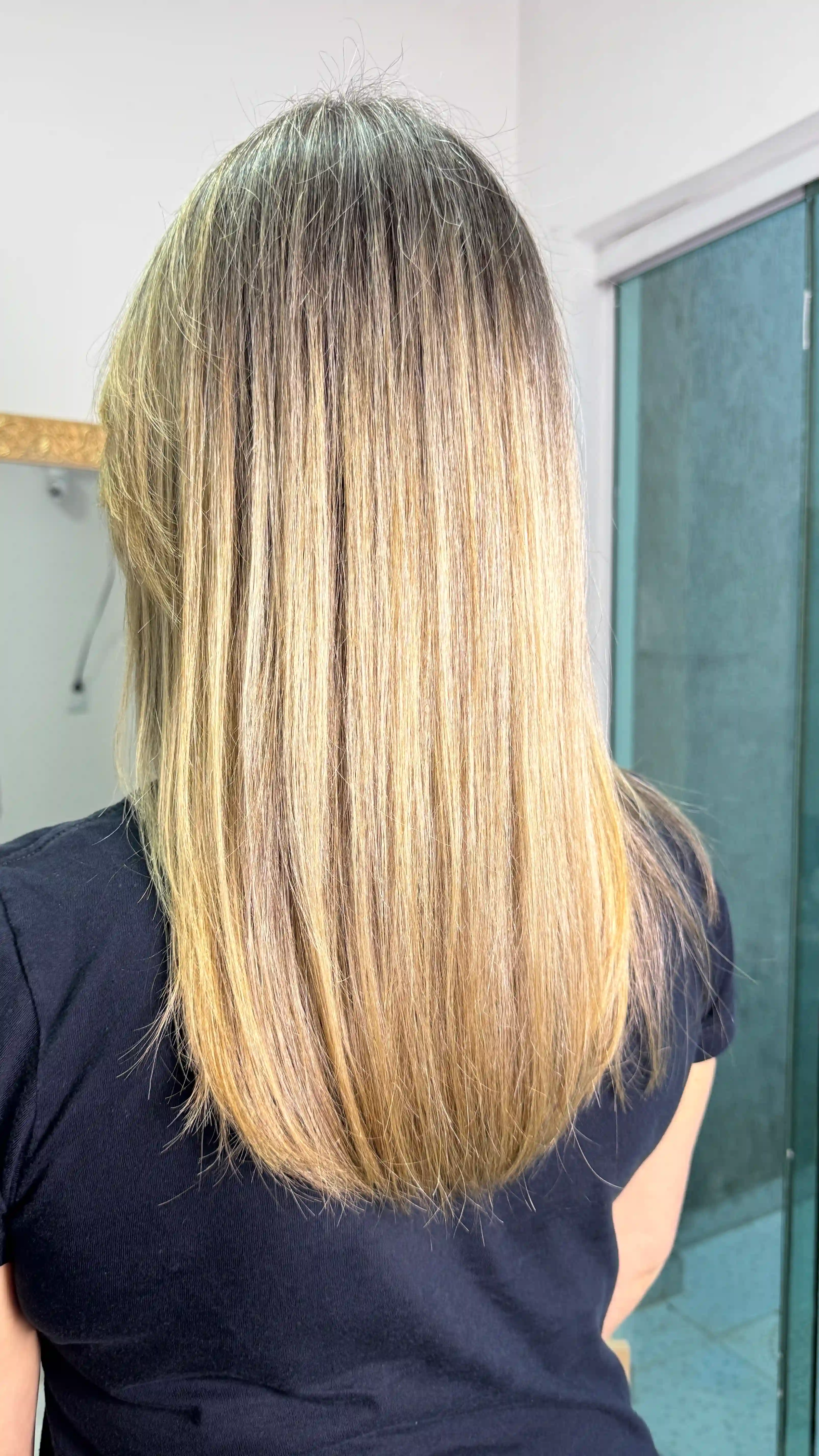 Antes e depois — tratamento de queda capilar em 5 Sessões — Rapha Beauty Tatuapé (Depois)
