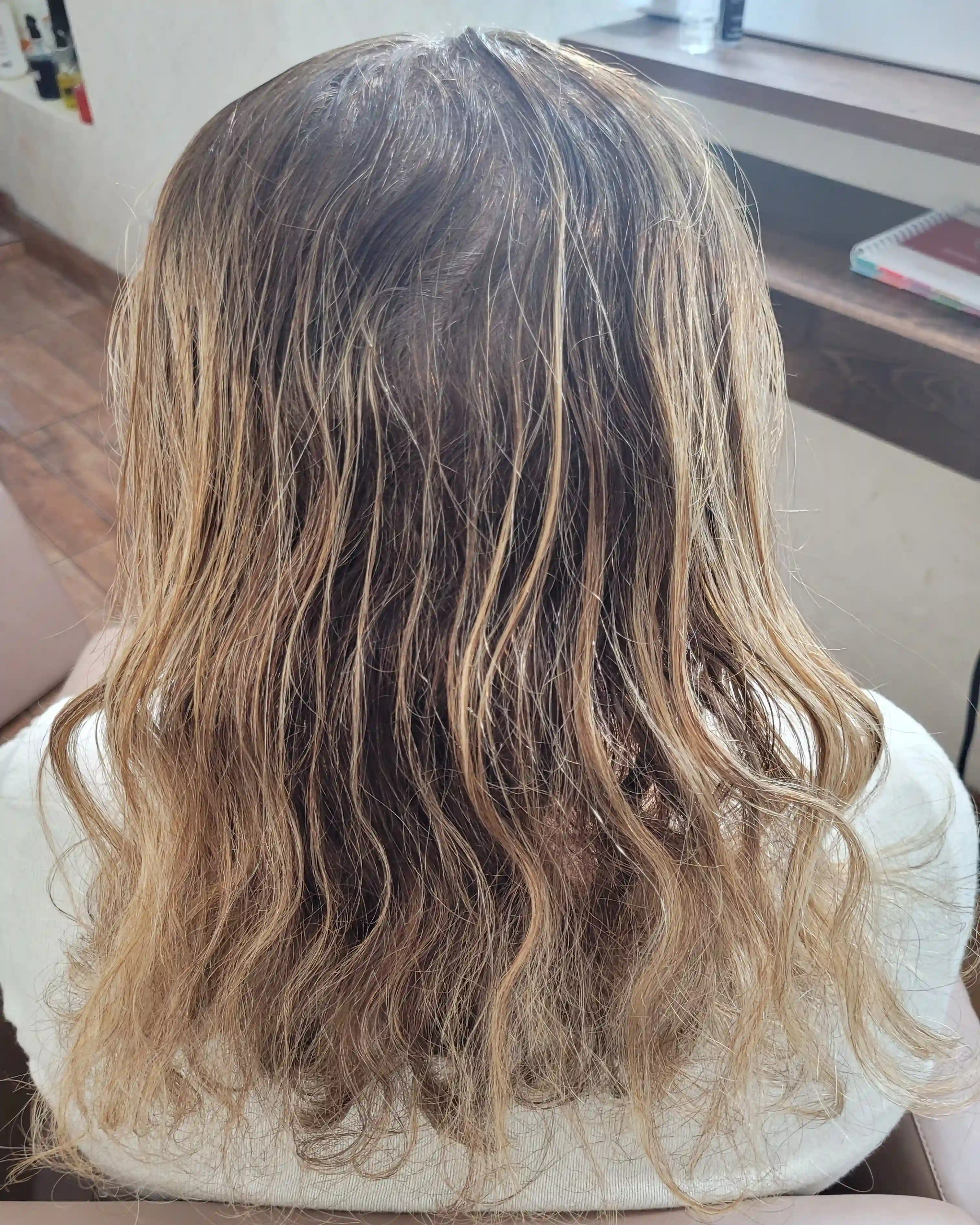 Antes e depois — tratamento de alopecia androgenética feminina em 6 Sessões — Rapha Beauty Tatuapé (Antes)